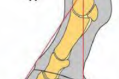 Request Quote: Equine Navicular Rehab - Horse Physical Therapy - Burbank, CA